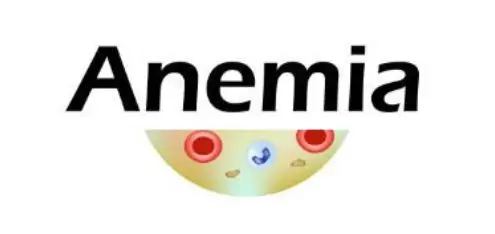 anemia